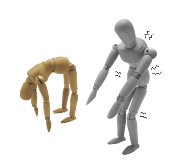 A espondilite anquilosante causa rigidez e dificuldade de movimentar a coluna.