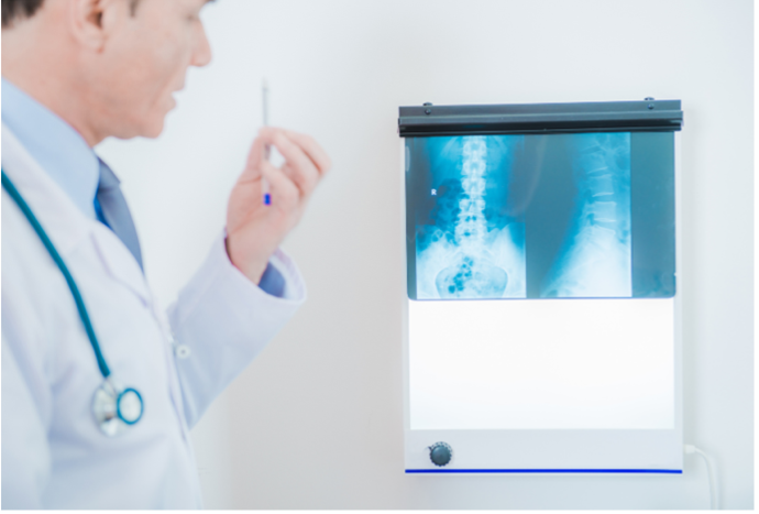 A radiografia de coluna é útil para avaliar fratura vertebral.